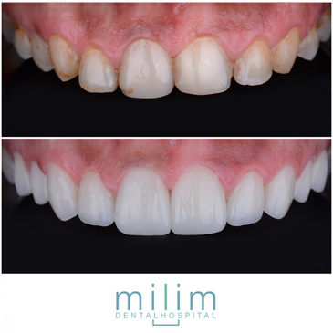 Slider image (5) Milim Dental